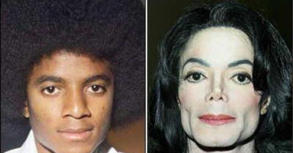 Джексон до и после пластики. Майкл Джексон до. Майкл Джексон ринопластика. Майкл Джексон до операции. Майкл Джексон пластические операции.